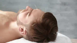 Acupuncture for Detox