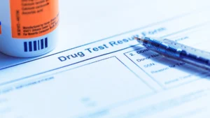Drug Test During Treatment
